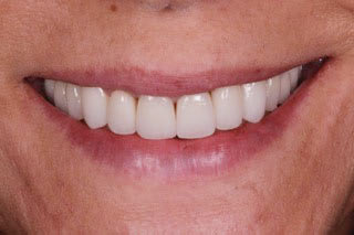 Switeeth - Dr. Jacques Cheylus - Dre Maëva Werlé gallery image 5