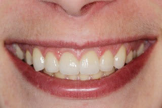 Switeeth - Dr. Jacques Cheylus - Dre Maëva Werlé gallery image 7