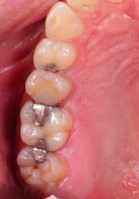 Switeeth - Dr. Jacques Cheylus - Dre Maëva Werlé gallery image 8