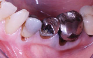 Switeeth - Dr. Jacques Cheylus - Dre Maëva Werlé gallery image 10