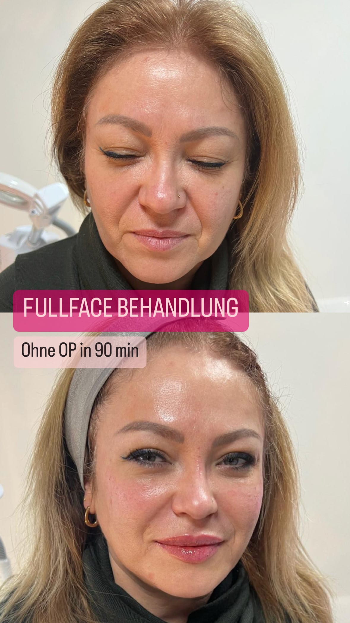 DIARFACE AESTHETICS - THE BEAUTY CLINIC gallery image 5