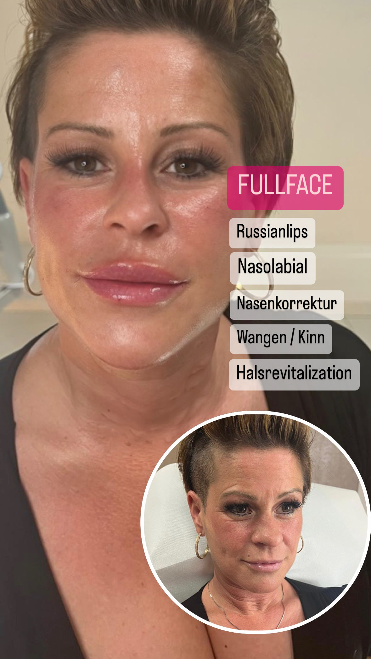 DIARFACE AESTHETICS - THE BEAUTY CLINIC gallery image 6