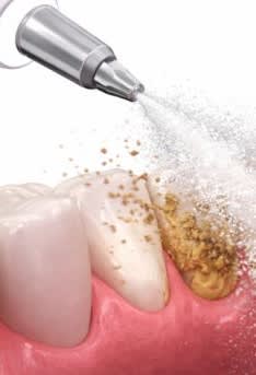 TEAM 15 - PRAXIS FÜR ZAHNMEDIZIN DR. HERMANN & PARTNER gallery image 6