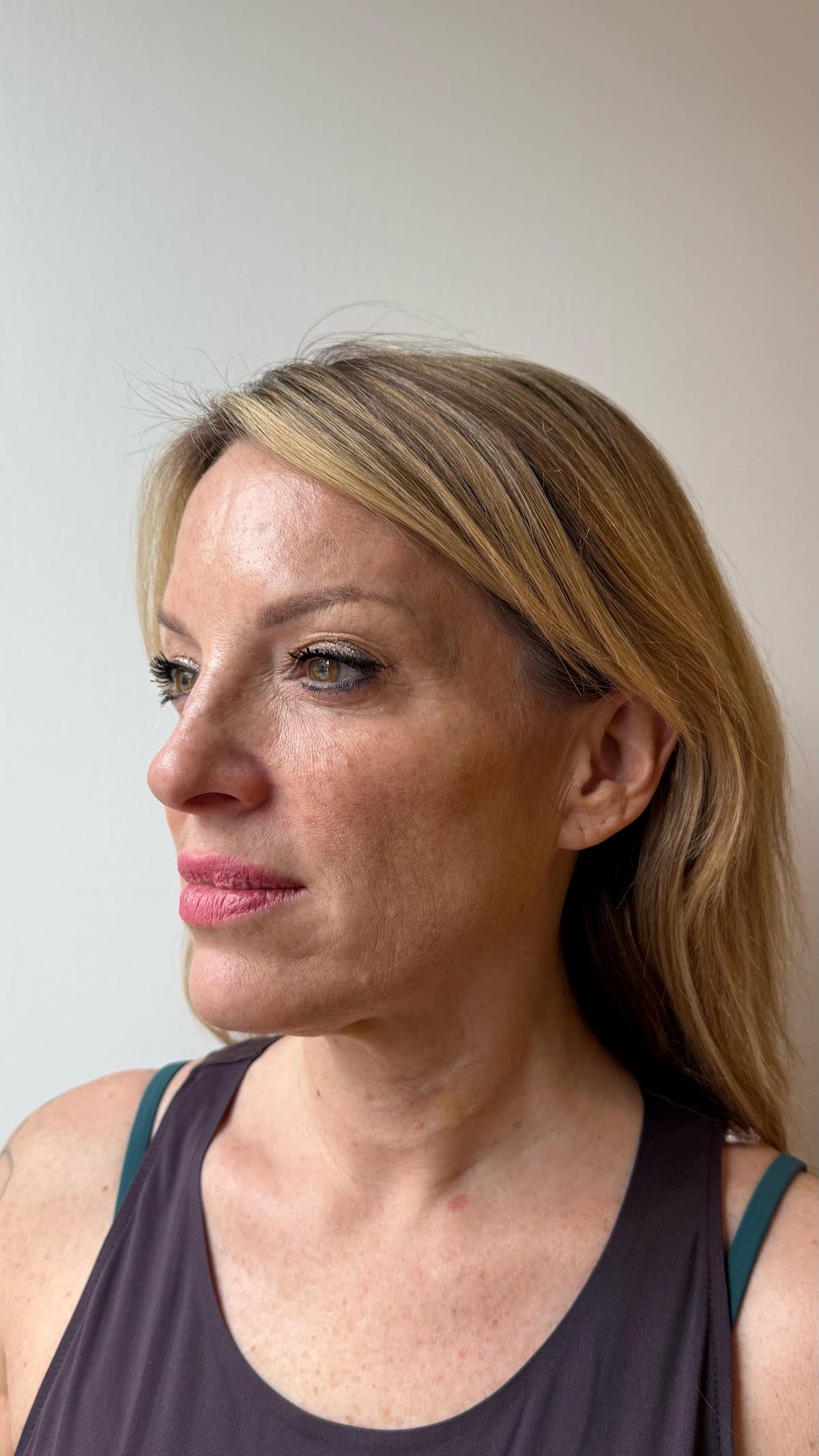 Aesthetics Clinic gallery image 1