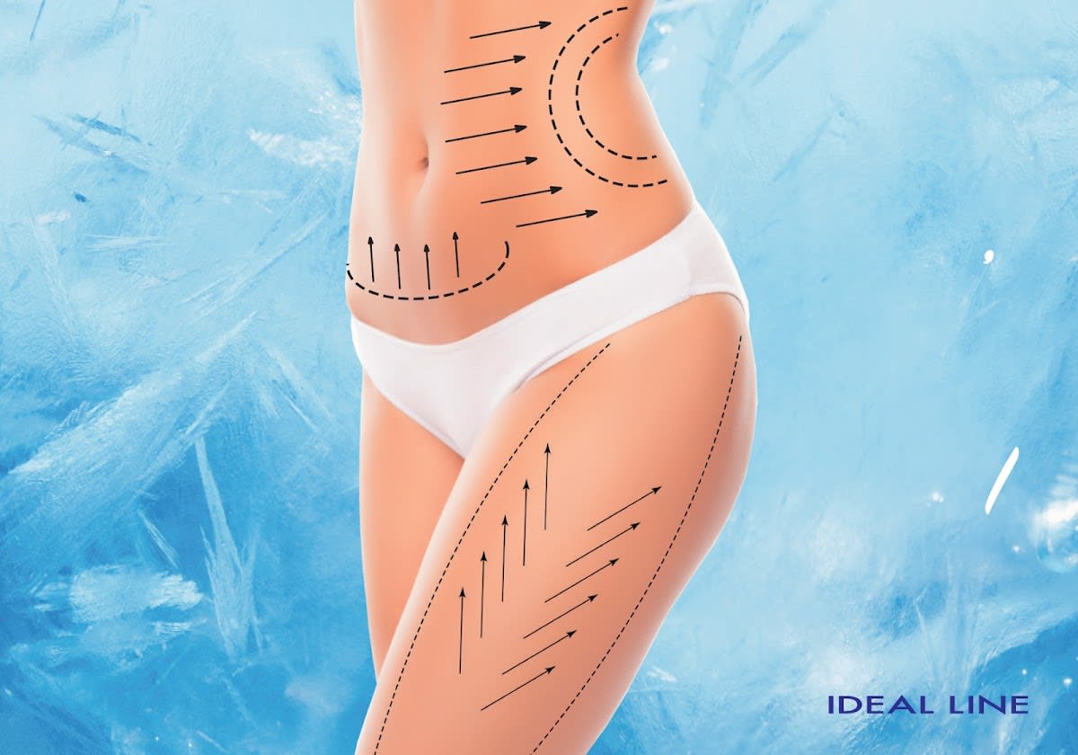 IDEAL LINE Genève gallery image 8