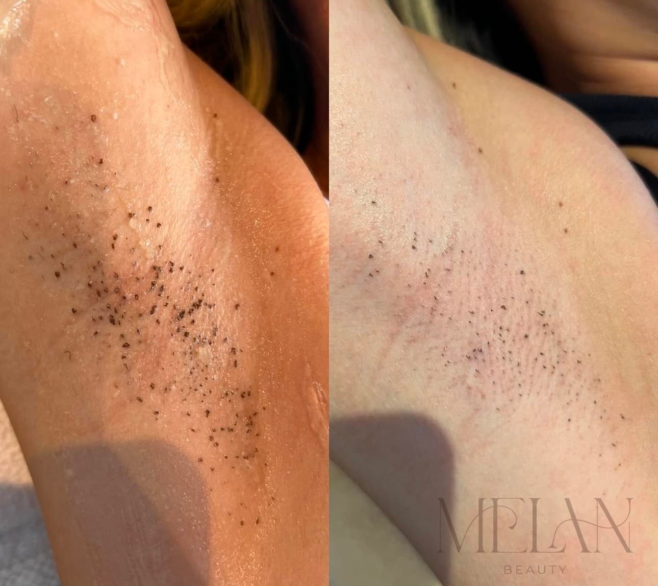 Melan Beauty gallery image 5