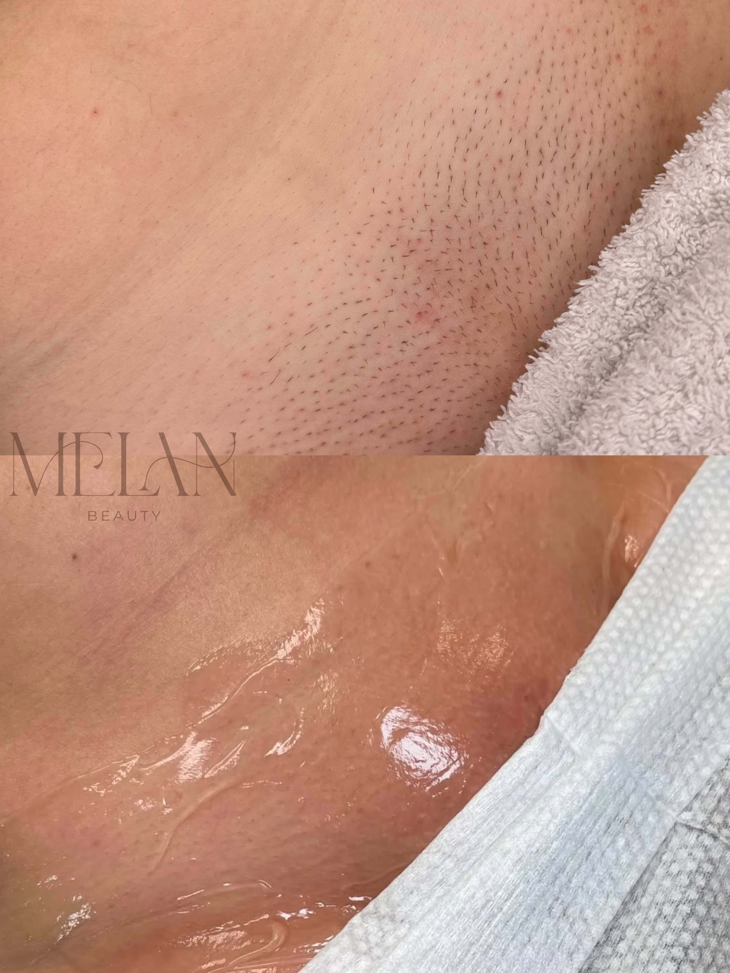 Melan Beauty gallery image 6