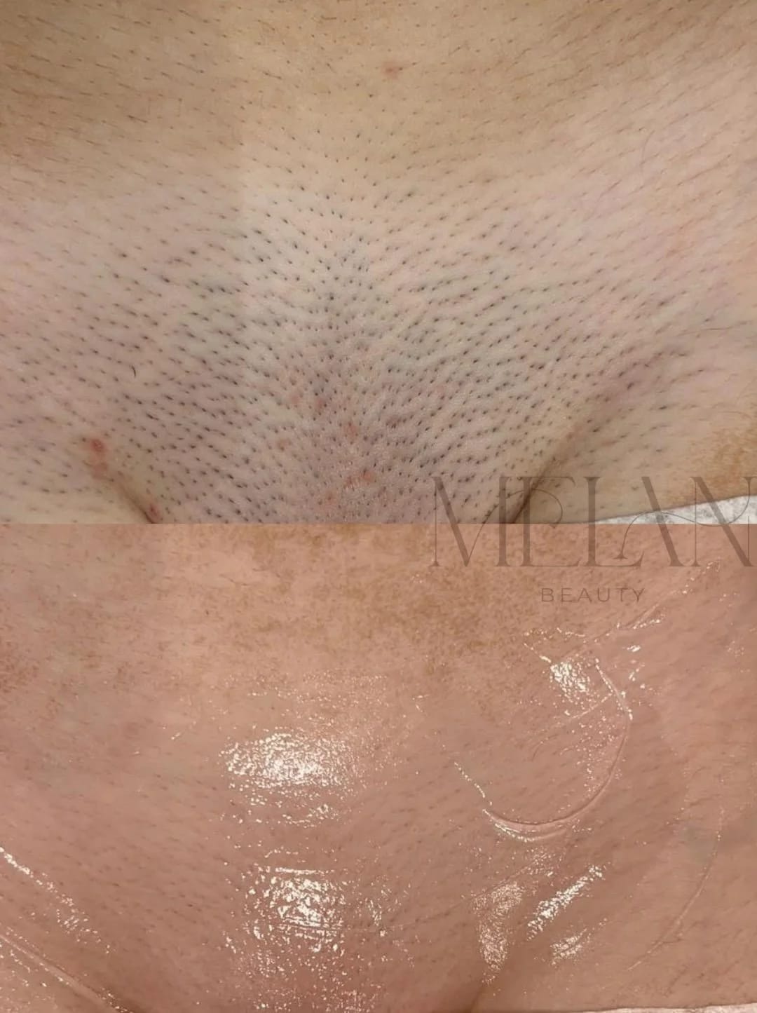 Melan Beauty gallery image 7