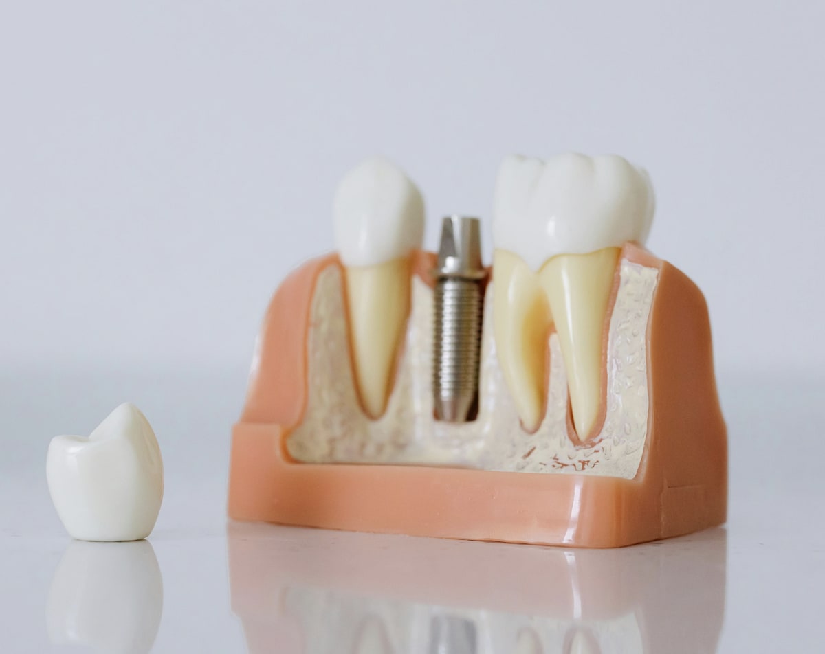 Dental Geneva gallery image 9