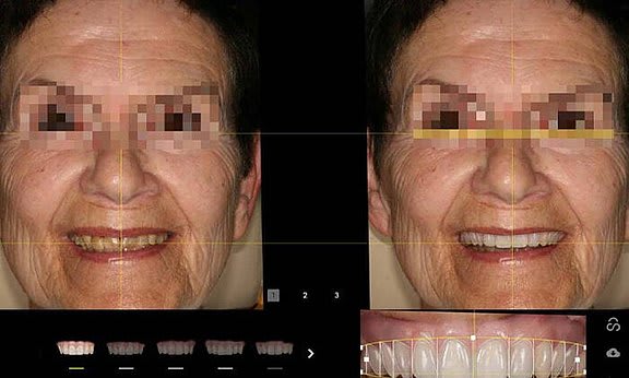 Zahnarzt Team Luzern | Dr. Schulte + Co. gallery image 2