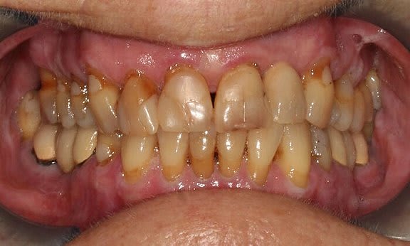 Zahnarzt Team Luzern | Dr. Schulte + Co. gallery image 3