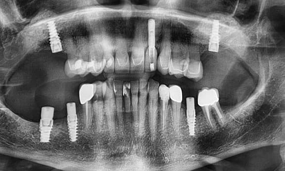 Zahnarzt Team Luzern | Dr. Schulte + Co. gallery image 4