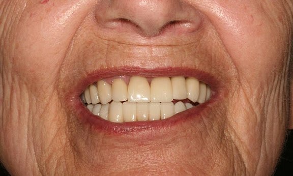 Zahnarzt Team Luzern | Dr. Schulte + Co. gallery image 5