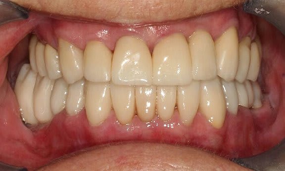 Zahnarzt Team Luzern | Dr. Schulte + Co. gallery image 6