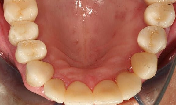 Zahnarzt Team Luzern | Dr. Schulte + Co. gallery image 7