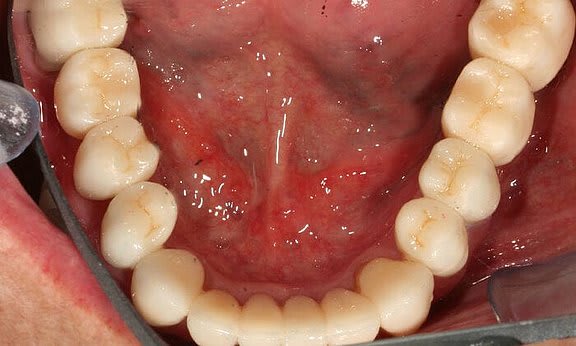 Zahnarzt Team Luzern | Dr. Schulte + Co. gallery image 8