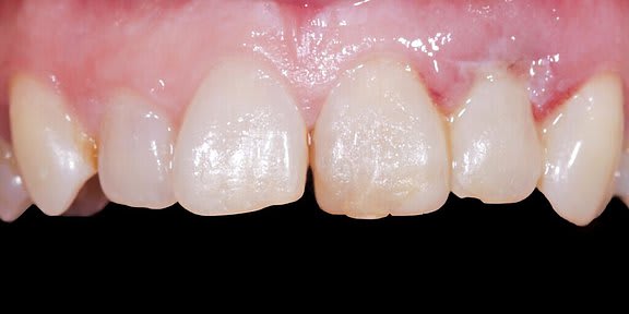 Zahnarzt Team Luzern | Dr. Schulte + Co. gallery image 9