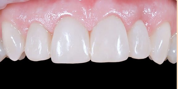 Zahnarzt Team Luzern | Dr. Schulte + Co. gallery image 10