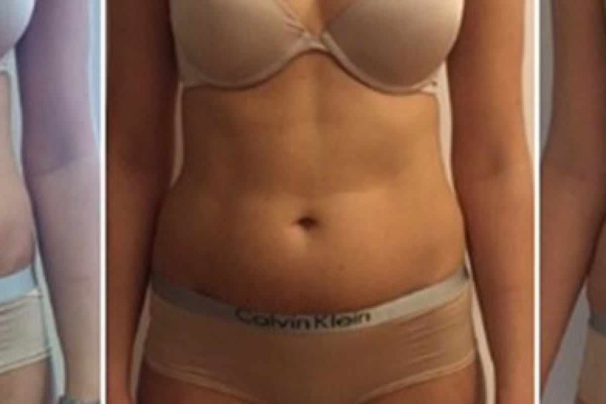 Dr. med. Nikolaus Linde | Schönheitsklinik St. Gallen gallery image 2