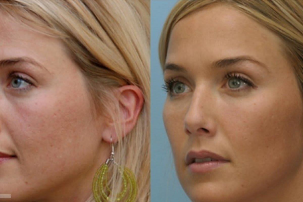 Dr. med. Nikolaus Linde | Schönheitsklinik St. Gallen gallery image 4