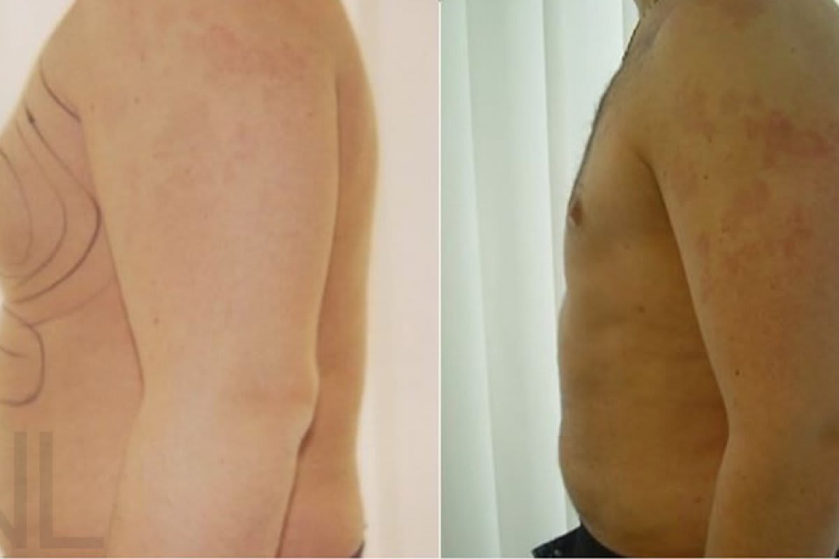 Dr. med. Nikolaus Linde | Schönheitsklinik St. Gallen gallery image 5