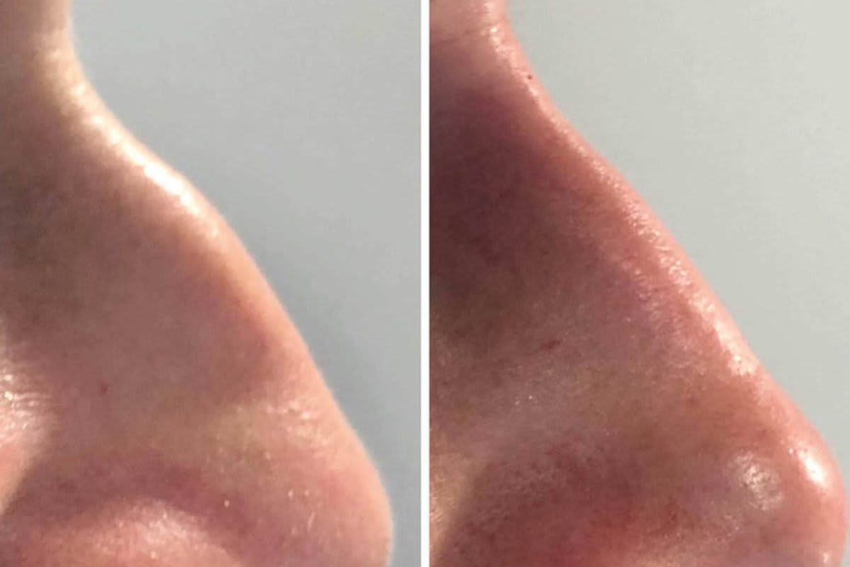 Dr. med. Nikolaus Linde | Schönheitsklinik St. Gallen gallery image 7