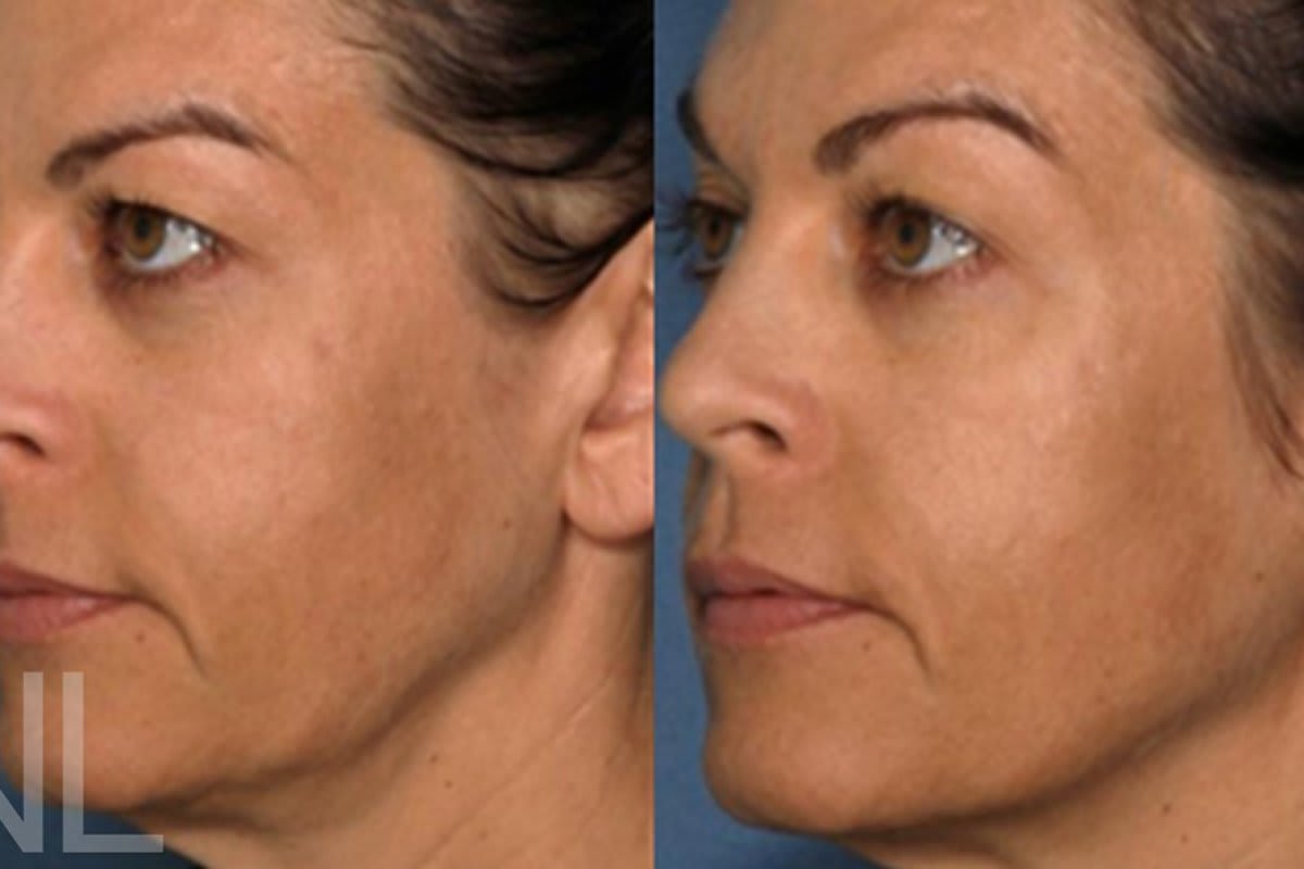 Dr. med. Nikolaus Linde | Schönheitsklinik St. Gallen gallery image 9