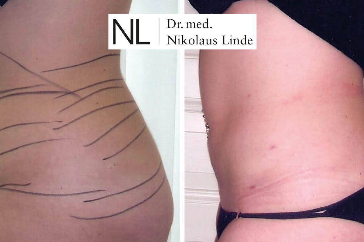 LIPOCLINIC St. Gallen gallery image 2