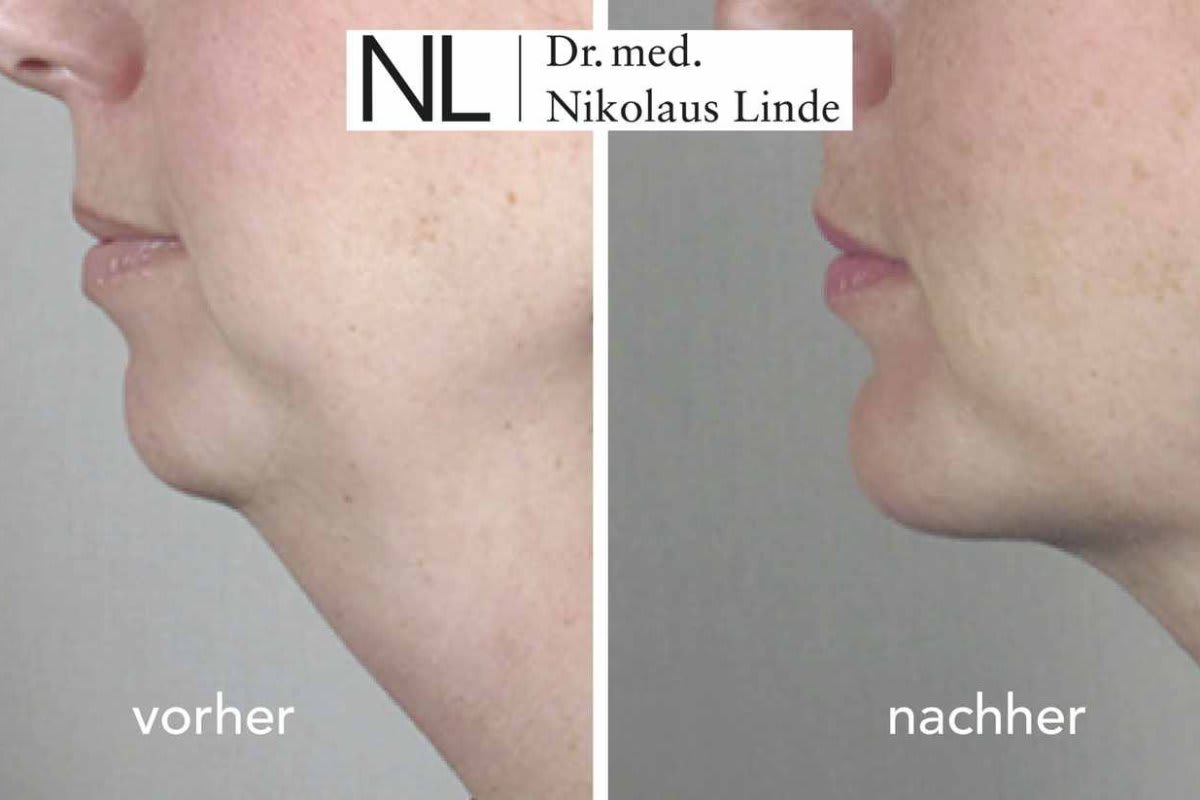 LIPOCLINIC St. Gallen gallery image 8
