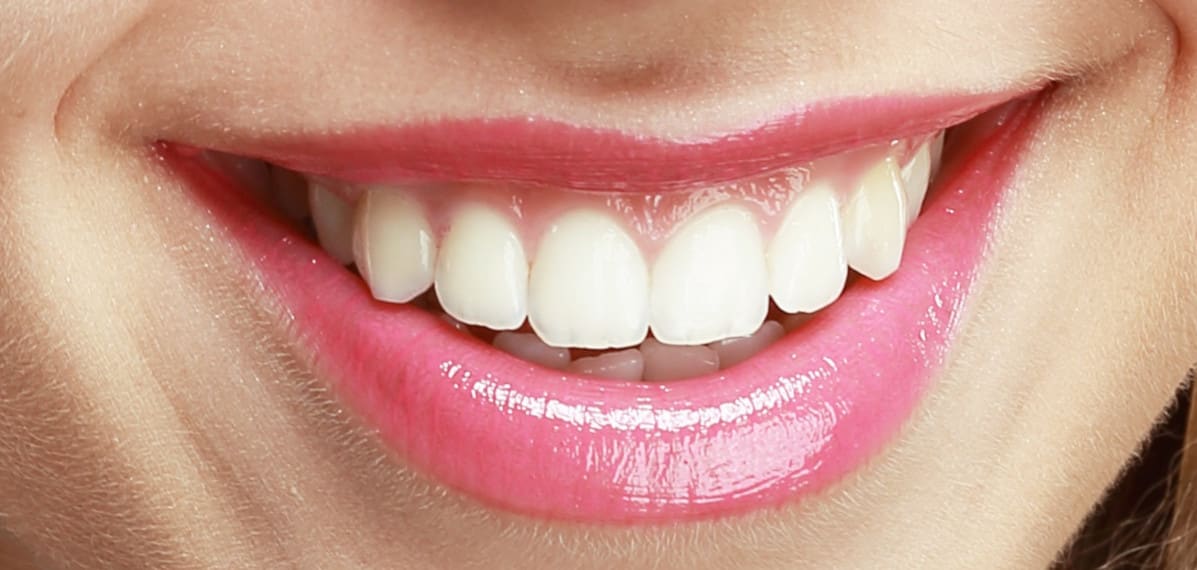 Smilezone Zahnarztpraxis | Dr.Gold und Yoo | Dentist Zug | Zuger Zahnärzte gallery image 7