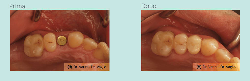 Dentisti Varini Michele gallery image 5