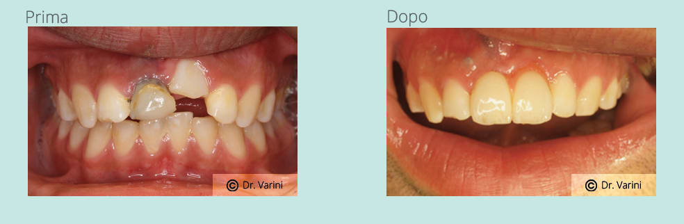 Dentisti Varini Michele gallery image 6