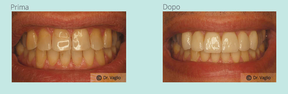 Dentisti Varini Michele gallery image 10