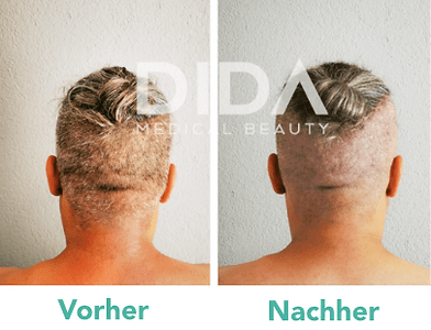 Dida Medical Beauty - Inh. Cengiz gallery image 6