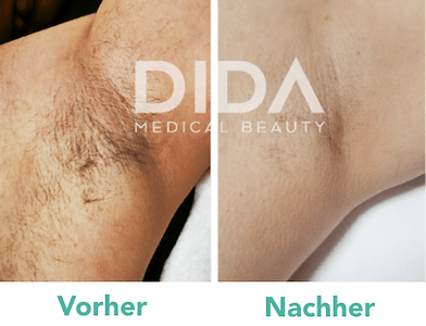 Dida Medical Beauty - Inh. Cengiz gallery image 7