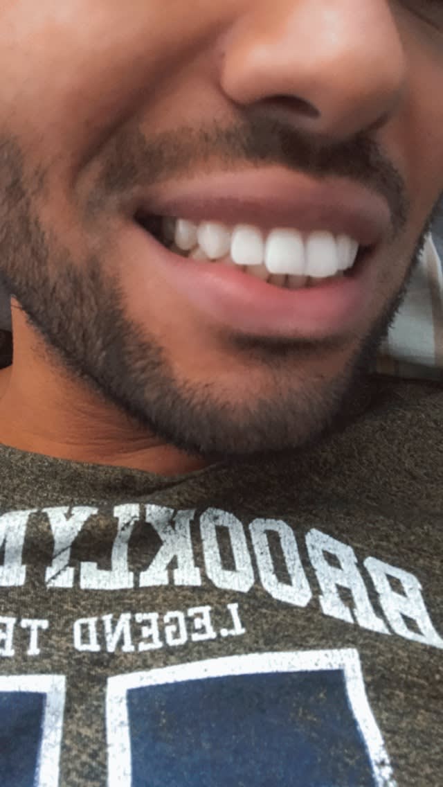 Adent | Dentiste Genève - Charmilles gallery image 10