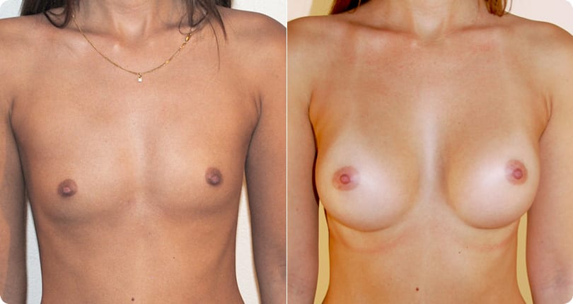 Kosmetische Chirurgie Zürich gallery image 1