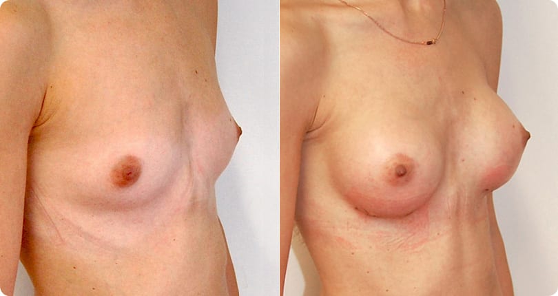 Kosmetische Chirurgie Zürich gallery image 2