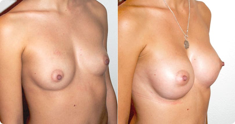 Kosmetische Chirurgie Zürich gallery image 3