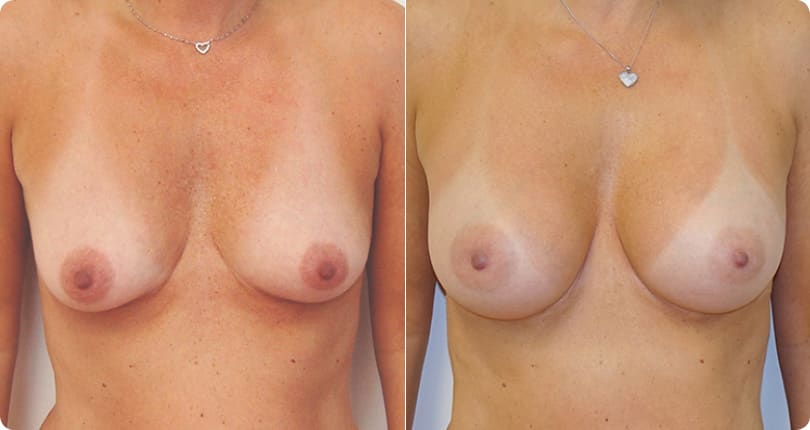 Kosmetische Chirurgie Zürich gallery image 4