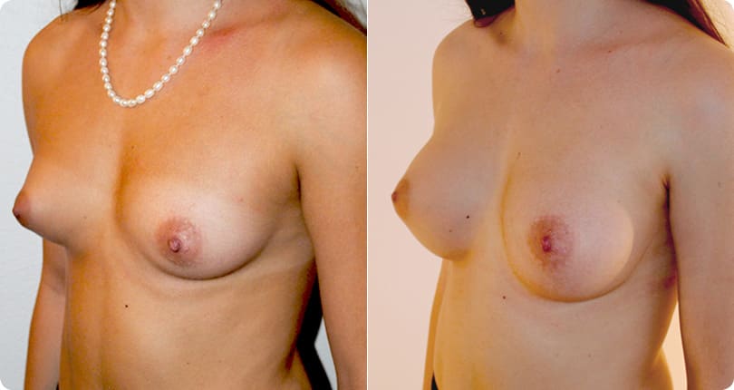 Kosmetische Chirurgie Zürich gallery image 6