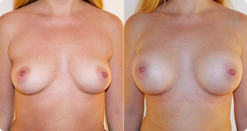 Kosmetische Chirurgie Zürich gallery image 7