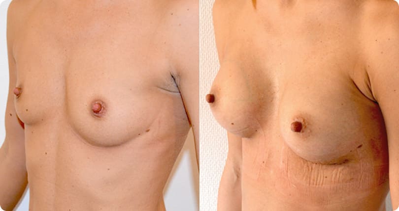 Kosmetische Chirurgie Zürich gallery image 8