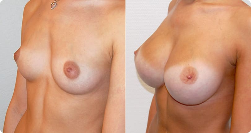 Kosmetische Chirurgie Zürich gallery image 9