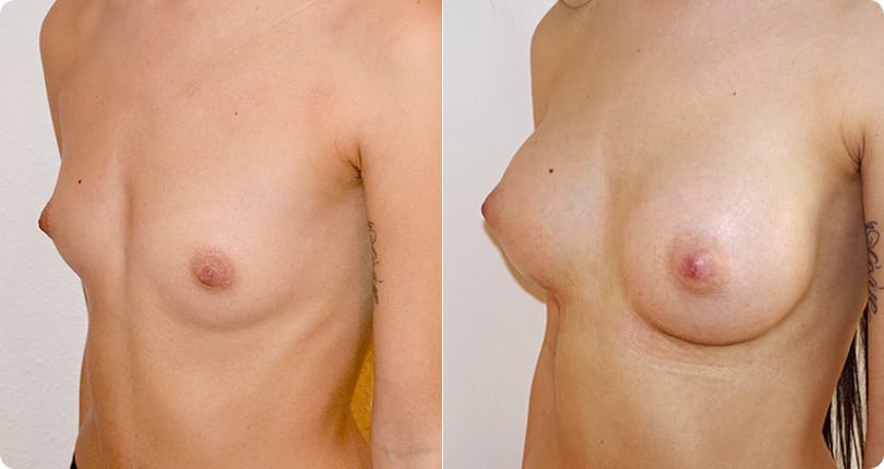 Kosmetische Chirurgie Zürich gallery image 10