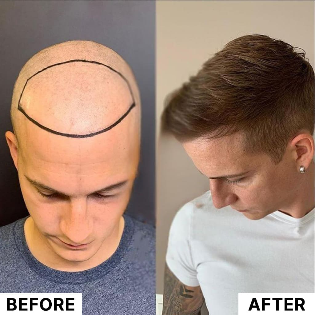 Sublime Clinic - Hair Transplant, Dental Implant Clinic gallery image 6