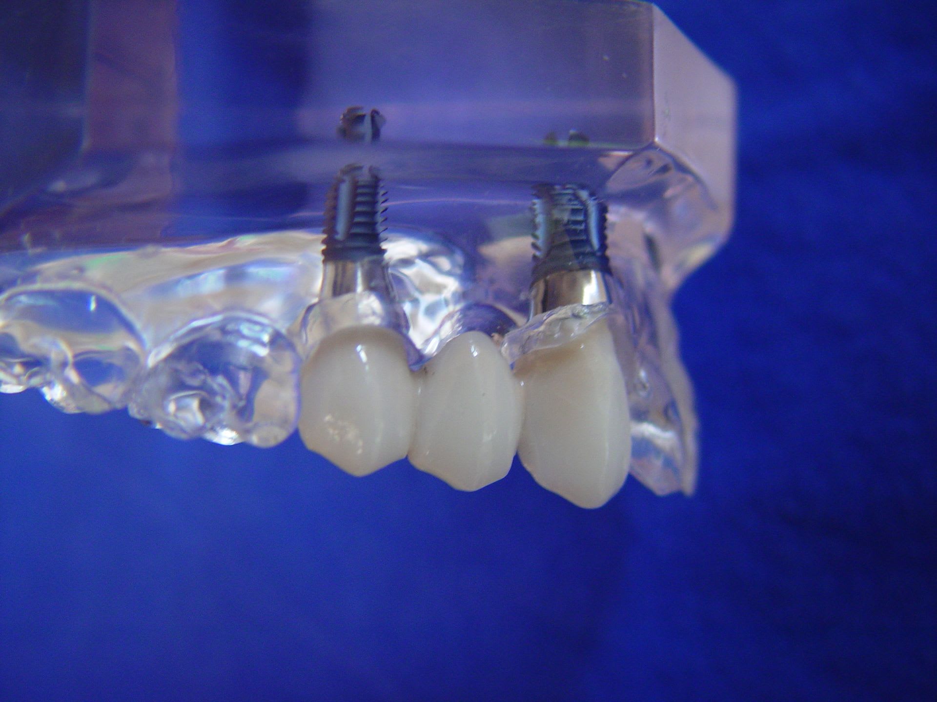 City-Zahnarzt Bern gallery image 6