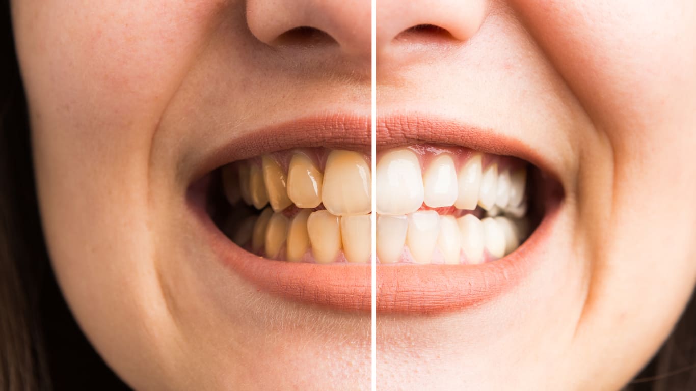 City-Zahnarzt Bern gallery image 7