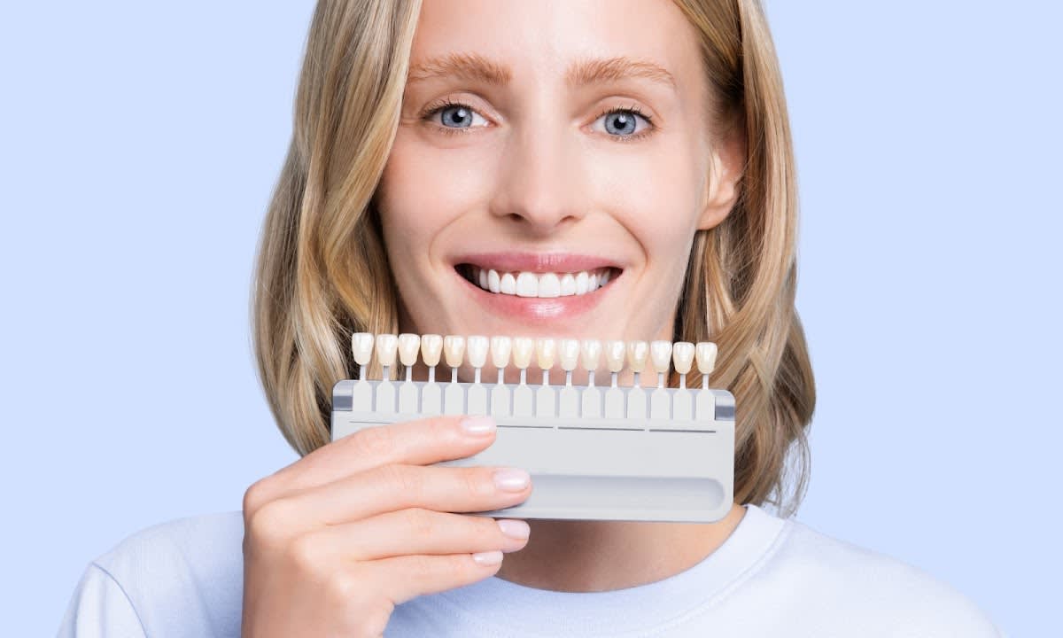 bestsmile Fribourg gallery image 4