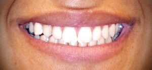 SunshineSmile Beratungszentrum Bern gallery image 2